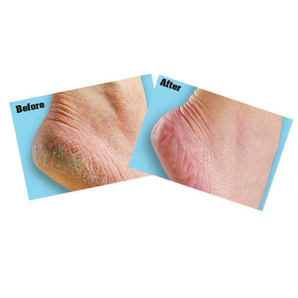 GRGOKHF85G Gorilla Glue O'Keeffe's Healthy Feet Foot Cream  85g Tube